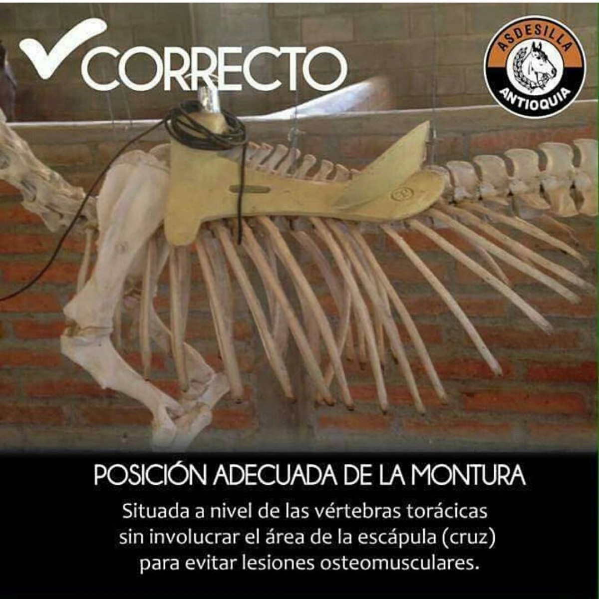 Posición Adecuada De La Montura!!